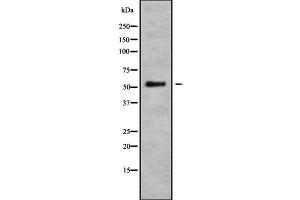 Western blot analysis GAS8 using HepG2 whole cell lysates (GAS8 antibody  (Internal Region))