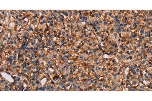 Plexin A1 antibody