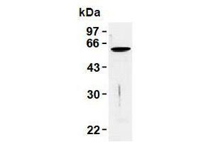 Western Blotting (WB) image for anti-Vimentin (VIM) antibody (ABIN1109486) (Vimentin antibody)
