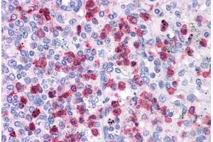 Human Spleen: Formalin-Fixed, Paraffin-Embedded (FFPE)