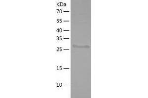 Western Blotting (WB) image for Actinin, alpha 3 (ACTN3) (AA 325-608) protein (His tag) (ABIN7121664) (ACTN3 Protein (AA 325-608) (His tag))