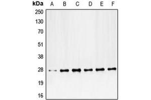 Western blot analysis of PDGFB expression in HeLa (A), NIH3T3 (B), mouse liver (C), mouse kidney (D), rat liver (E), rat kidney (F) whole cell lysates. (PDGFB antibody  (Center))