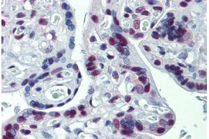 Human Placenta: Formalin-Fixed, Paraffin-Embedded (FFPE) (CUL9 antibody)
