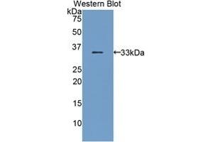 Detection of Recombinant BST1, Mouse using Polyclonal Antibody to Bone Marrow Stromal Cell Antigen 1 (BST1) (BST1 antibody  (AA 28-282))