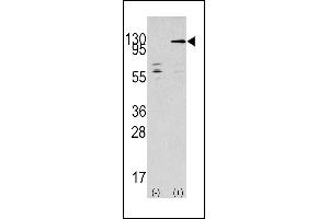 Western blot analysis of TAOK3 (arrow) using rabbit polyclonal TAOK3 Antibody (C-term) (ABIN390997 and ABIN2841175). (TAO Kinase 3 antibody  (C-Term))