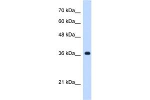 WB Suggested Anti-C19orf47 Antibody Titration:  0. (C19orf47 antibody  (C-Term))