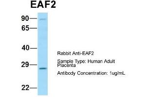 Host: Rabbit  Target Name: EAF2  Sample Tissue: Human Adult Placenta  Antibody Dilution: 1.