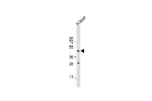 MMAA antibody  (N-Term)