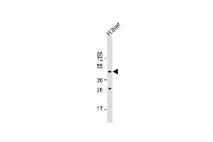 Anti- Antibody (N-term) at 1:500 dilution + human liver lysate Lysates/proteins at 20 μg per lane. (MMAA antibody  (N-Term))