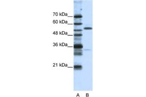 Western Blotting (WB) image for anti-Zinc Finger Protein 655 (ZNF655) antibody (ABIN2461928) (ZNF655 antibody)