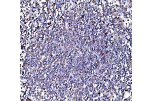 IHC analysis of PMPCA/INPP5 using anti-PMPCA/INPP5 antibody (ABIN7602722). (PMPCA antibody  (AA 99-525))