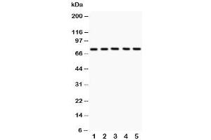 Western blot testing of 12 Lipoxygenase antibody and Lane 1:  A549 (12-Lipoxygenase antibody  (C-Term))