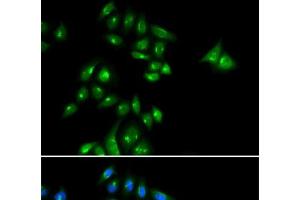 Immunofluorescence analysis of U2OS cells using PHC3 Polyclonal Antibody (PHC3 antibody)