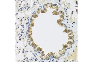 Immunohistochemistry of paraffin-embedded mouse lung using CRTAP antibody (ABIN5972488) at dilution of 1/100 (40x lens). (CRTAP antibody)