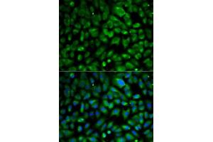 Immunofluorescence analysis of MCF7 cells using eIF4E antibody . (EIF4E antibody  (AA 1-217))