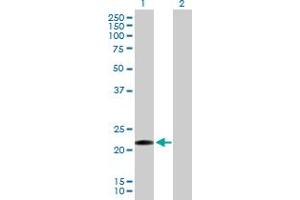 Western Blot analysis of CLEC1B expression in transfected 293T cell line by CLEC1B MaxPab polyclonal antibody. (C-Type Lectin Domain Family 1, Member B (CLEC1B) (AA 1-196) antibody)