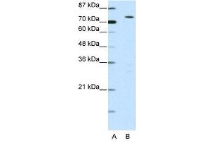 WB Suggested Anti-MYST2  Antibody Titration: 0. (MYST2 antibody  (N-Term))