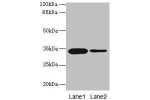 Western blot All lanes: OGN antibody at 14 μg/mL Lane 1: Rat liver tissue Lane 2: 293T whole cell lysate Secondary Goat polyclonal to rabbit IgG at 1/10000 dilution Predicted band size: 34 kDa Observed band size: 34 kDa (OGN antibody  (AA 21-298))