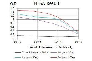 Black line: Control Antigen (100 ng), Purple line: Antigen(10 ng), Blue line: Antigen (50 ng), Red line: Antigen (100 ng), (CYP1A1 antibody)