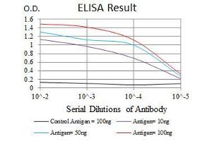 Black line: Control Antigen (100 ng), Purple line: Antigen(10 ng), Blue line: Antigen (50 ng), Red line: Antigen (100 ng), (CYP1A1 antibody)