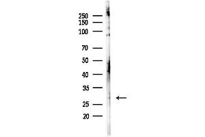 anti-C-Type Lectin Domain Family 4, Member D (CLEC4D) (Internal Region) antibody