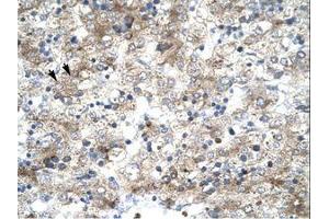 Image no. 2 for anti-General Transcription Factor IIH, Polypeptide 1, 62kDa (GTF2H1) (N-Term) antibody (ABIN202744) (GTF2H1 antibody  (N-Term))