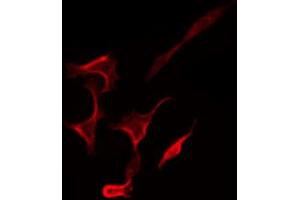 ABIN6267269 staining SK-OV3 by IF/ICC. (EGFR antibody  (pSer1071))