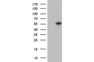 HEK293T cells were transfected with the pCMV6-ENTRY control (Left lane) or pCMV6-ENTRY AKT1 (Right lane) cDNA for 48 hrs and lysed. (AKT1 antibody)