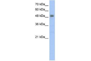 RSAD2 antibody used at 5 ug/ml to detect target protein.