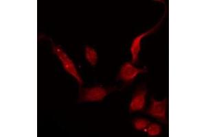Immunofluorescence (fixed cells) (IF/ICC) image for anti-Guanine Nucleotide Binding Protein (G Protein), alpha Transducing Activity Polypeptide 2 (GNAT2) (N-Term) antibody (ABIN6259288)