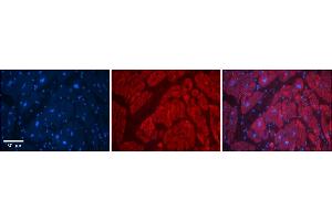 Rabbit Anti-SLC6A5 Antibody    Formalin Fixed Paraffin Embedded Tissue: Human Adult heart  Observed Staining: Cytoplasmic Primary Antibody Concentration: 1:600 Secondary Antibody: Donkey anti-Rabbit-Cy2/3 Secondary Antibody Concentration: 1:200 Magnification: 20X Exposure Time: 0.