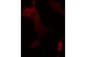 ABIN6275650 staining  293 cells by IF/ICC. (USP11 antibody  (Internal Region))