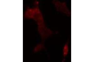 ABIN6275650 staining  293 cells by IF/ICC. (USP11 antibody  (Internal Region))