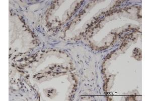 Immunostaining (ISt) image for anti-SWI/SNF Related, Matrix Associated, Actin Dependent Regulator of Chromatin, Subfamily A, Member 5 (SMARCA5) (AA 59-147) antibody (ABIN521926)