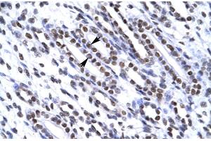 Immunohistochemistry (IHC) image for anti-X-Ray Repair Complementing Defective Repair in Chinese Hamster Cells 6 (XRCC6) (N-Term) antibody (ABIN2778270)