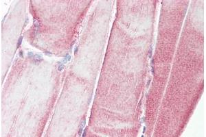 Anti-HSPB1 antibody IHC staining of human skeletal muscle. (HSP27 antibody  (AA 45-94))