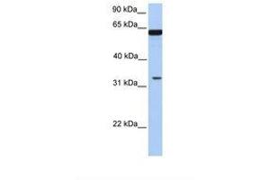 PGAP3 antibody  (N-Term)