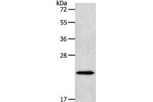 Western Blot analysis of Human liver cancer tissue using NEUROG1 Polyclonal Antibody at dilution of 1:400 (Neurogenin 1 antibody)