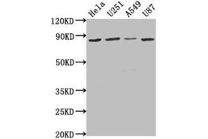 Western Blot Positive WB detected in: Hela whole cell lysate, U251 whole cell lysate, A549 whole cell lysate, U87 whole cell lysate All lanes: VPS51 antibody at 1:1000 Secondary Goat polyclonal to rabbit IgG at 1/50000 dilution Predicted band size: 87, 73 kDa Observed band size: 87 kDa (VPS51 antibody  (AA 595-673))