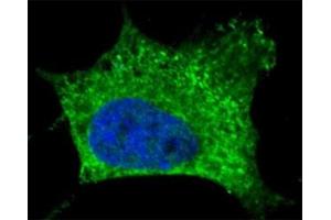 Fluorescent confocal image of SY5Y cells stained with NGFR antibody. (NGFR antibody)