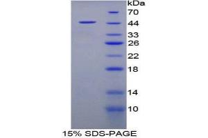 SDS-PAGE (SDS) image for Fatty Acid Binding Protein 4, Adipocyte (FABP4) (AA 2-132) protein (His tag,GST tag) (ABIN2122814)