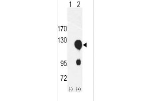 Western blot analysis of ROR2 using rabbit polyclonal ROR2 Antibody using 293 cell lysates (2 ug/lane) either nontransfected (Lane 1) or transiently transfected with the ROR2 gene (Lane 2).