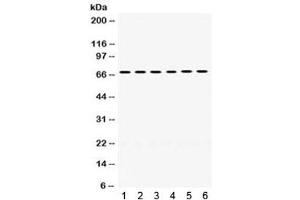 Western blot testing of 1) rat liver, 2) rat lung, 3) mouse liver, 4) mouse lung, 5) human COLO320 and 6) human MCF7 lysate with PDPK1 antibody. (PDPK1 antibody)