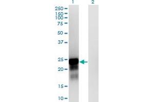 Western Blot analysis of SPANXN3 expression in transfected 293T cell line by SPANXN3 monoclonal antibody (M01), clone 1F11. (SPANXN3 antibody  (AA 1-141))