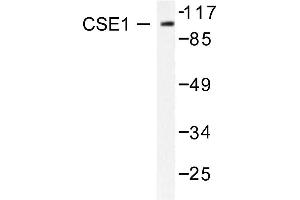 Image no. 2 for anti-CSE1 Chromosome Segregation 1-Like (CSE1L) antibody (ABIN265374) (Exportin 2 antibody)