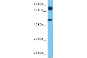 Host:  Rabbit  Target Name:  LRP3  Sample Type:  PANC1 Whole Cell lysates  Antibody Dilution:  1. (LRP3 antibody  (N-Term))