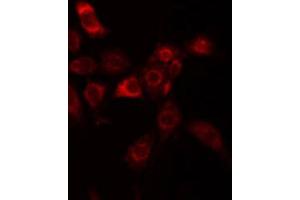 Immunofluorescence (fixed cells) (IF/ICC) image for anti-UDP-Gal:betaGlcNAc beta 1,3-Galactosyltransferase, Polypeptide 1 (B3GALT1) (N-Term) antibody (ABIN6258646)
