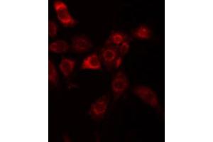 ABIN6274904 staining HuvEc by IF/ICC. (B3GALT1 antibody  (N-Term))