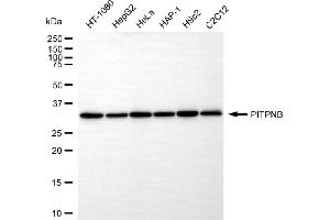 anti-Phosphotidylinositol Transfer Protein, beta (PITPNB) antibody