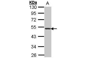 WB Image Sample (30 ug of whole cell lysate) A: Hep G2 , 10% SDS PAGE antibody diluted at 1:1000 (CXCR5 antibody)